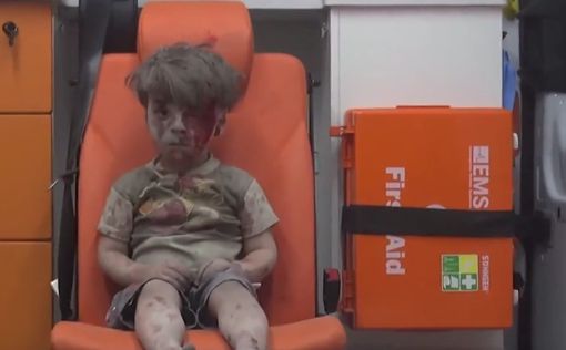 Сирия: кадры раненого мальчика шокировали общественность